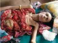 എയ്ഡ്‌സ് ബാധിച്ച് മരിച്ച ഈ പ്രശസ്ത തെന്നിന്ത്യന്‍ നായിക ആര്... ? ജീവിയ്ക്കാൻ പിച്ച എടുത്തു !!!