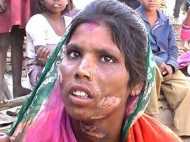 ഭാര്യയുടെ സ്വകാര്യ ഭാഗങ്ങൾ ഭർത്താവ് പൊള്ളിച്ചു!!! അജ്ഞാതനോട് ഫോണിൽ സംസാരിച്ചതിന്