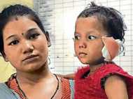 മകളുടെ നന്മക്കു വേണ്ടി അച്ഛൻ മൂന്നു വയസുകാരിയുടെ ചെവി മുറിച്ചെടുത്തു!!!