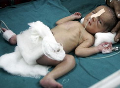 Newborn baby survives train toilet slip,