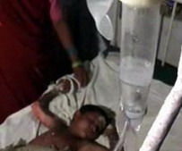 Dalit Girl burnt