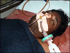 Khan's condition has shown a little improvement now