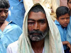 Man gouges out eye to please God!