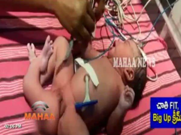 ശസ്ത്രക്രിയ ഉടന്...