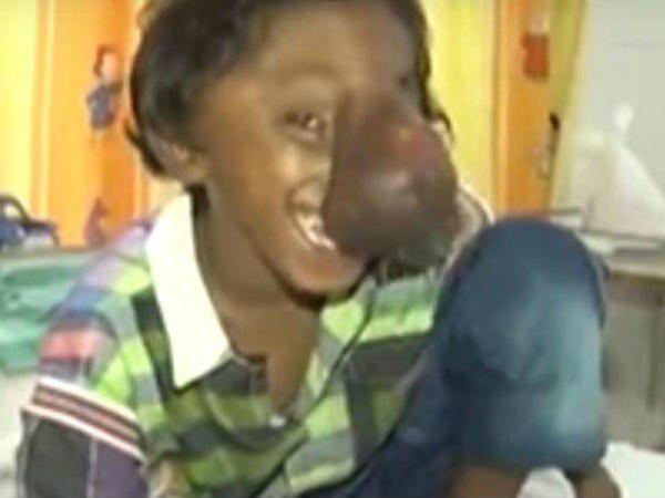 തുമ്പിക്കൈ മൂക്ക്
