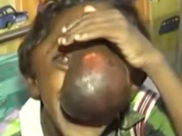 തലച്ചോറിന്റെ ഭാഗം