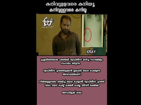 അത് നൂഡില്സ് ആയിരുന്നോ!!!