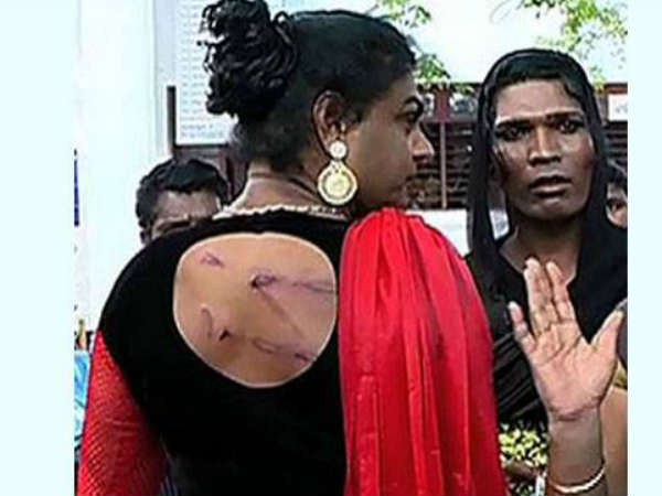 ലാത്തികൊണ്ട് മര്ദനം, കൈയ്യൊടിച്ചു