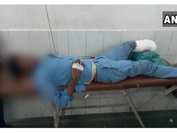 മുറിച്ച് മാറ്റിയ കാല്
