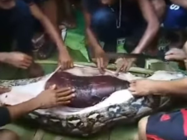 വയറുകീറി പരിശോധന