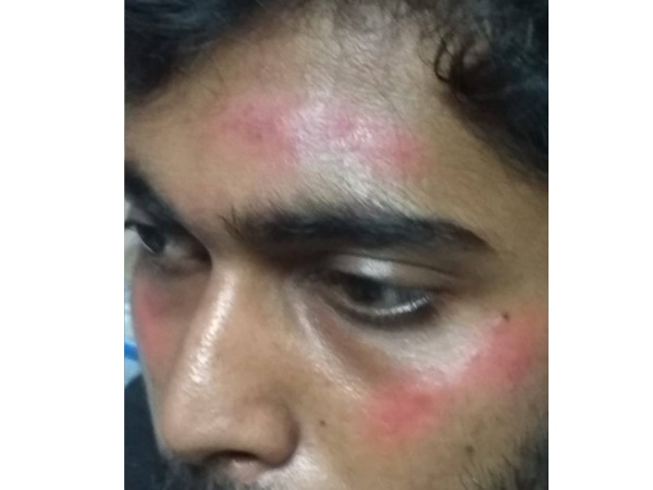 തലക്കും രണ്ട് ചെവിക്കും തോളെല്ലിനും