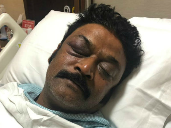 ഗുരുതരമായ പരിക്ക്