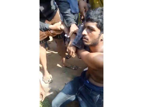 പൊള്ളലേറ്റിട്ടുണ്ട്