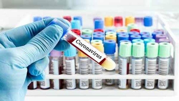 എന്താണ് റാപിഡ് ടെസ്റ്റ്