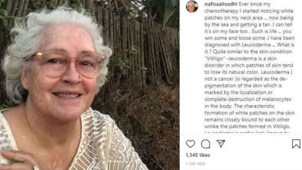 ശരീരത്തിന്റെ നിറം