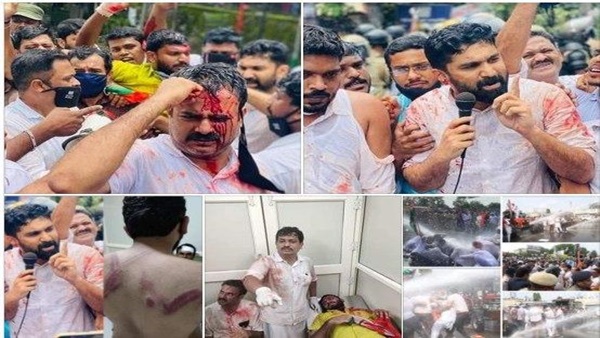 കർഷക ബില്ലുകൾക്കെതിരെ