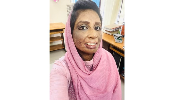 പൊള്ളിക്കരിഞ്ഞിരിക്കുകയല്ലേ, എന്തിനാ പഠിപ്പിച്ചു പൈസ കളയുന്നത്?