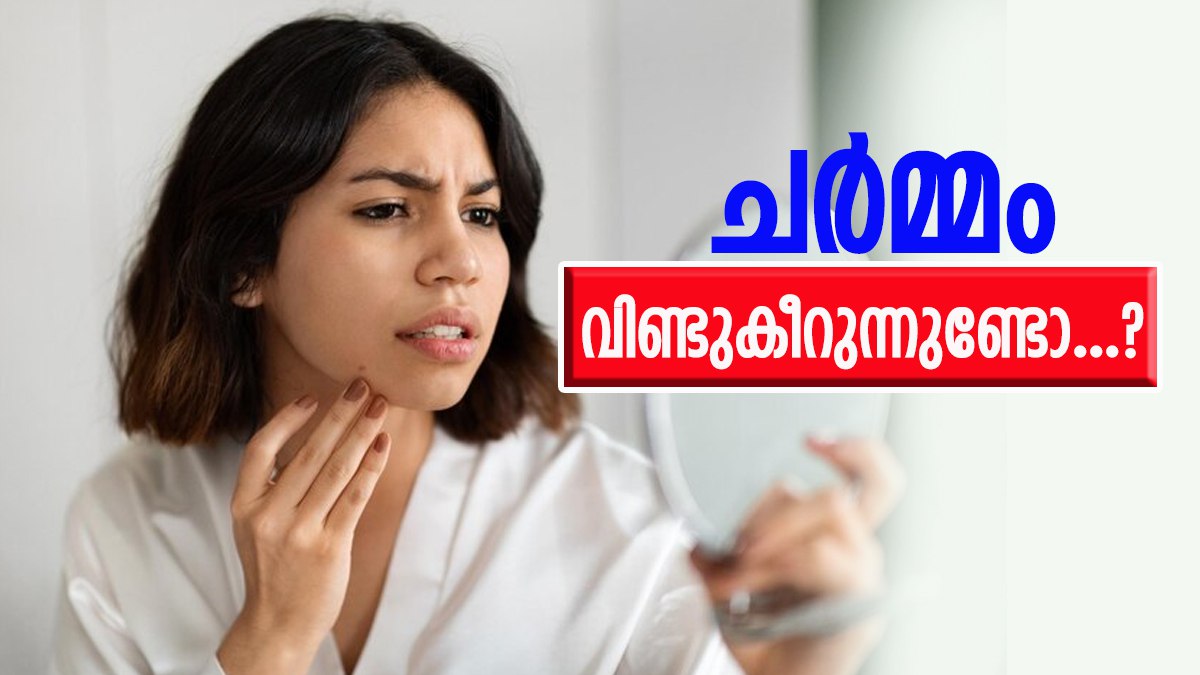 ചർമ്മം വരണ്ട് തുടങ്ങിയോ, ചൊറിച്ചലുമുണ്ടോ?; പരിഹാരമുണ്ട്, വീട്ടിൽ തന്നെ