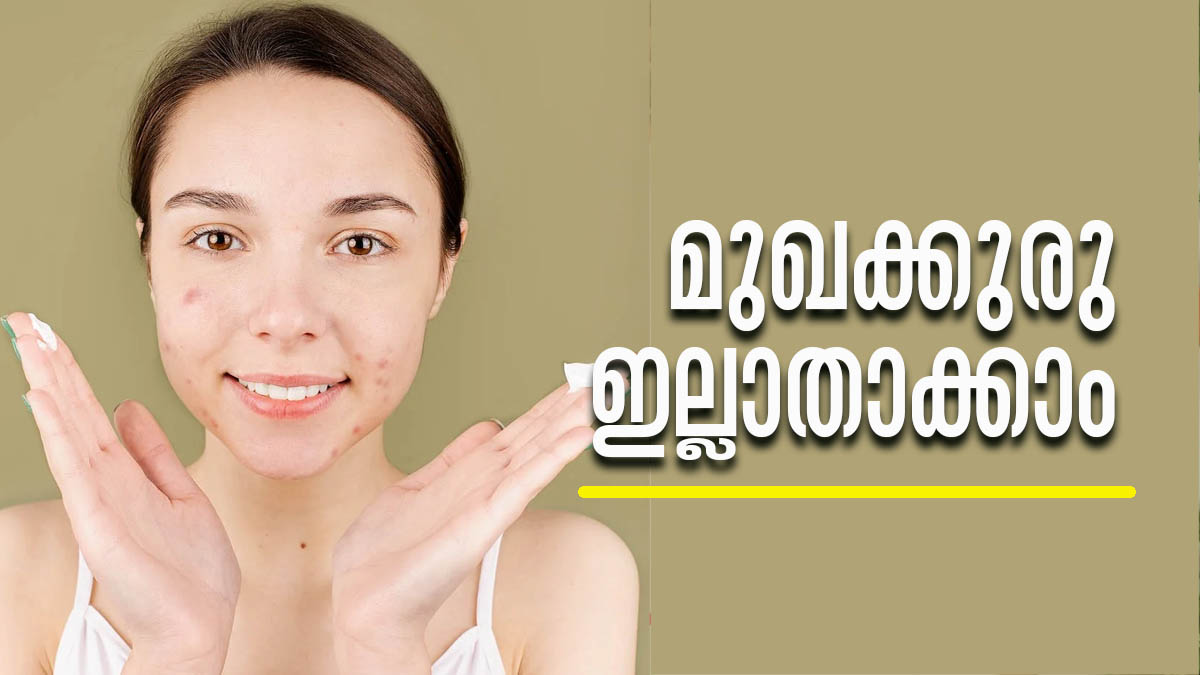 മുഖക്കുരുവാണോ നിങ്ങളുടെ പ്രശ്‌നം; ഇനി വിഷമിക്കേണ്ട.. വീട്ടില്