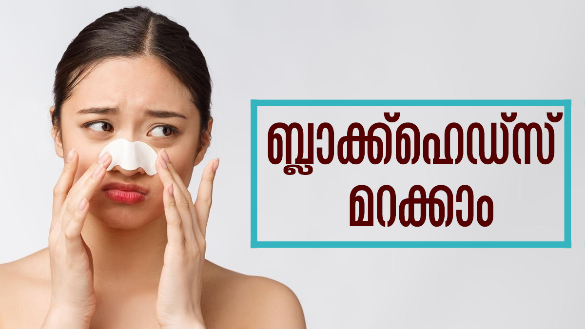 ബ്ലാക്ക്‌ഹെഡ്‌സ് മറന്നേക്കൂ... ഇനി പാര്‍ലറിലൊന്നും പോകേണ്ട; വീട്ടില്